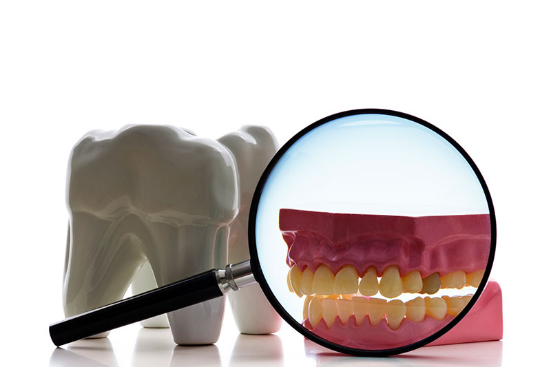 Root Canal in Brookfield